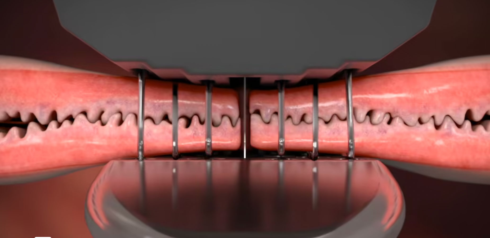 Animation showcasing Medtronic TriStaple product for medical procedures. Compares TriStaple Curved Tip pivoting anvil reloads to Competitor's fixed anvil reloads for superior performance. Tri-Staple™ technology reloads work in harmony with tissue properties, generating less stress on tissue. Ideal for reliable and effective medical procedures.