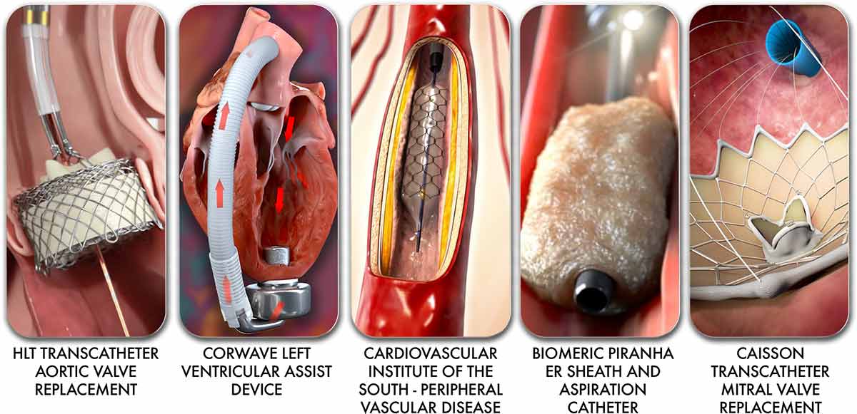 Ghost Medical Animation: Bringing Medical Concepts to Life for ProMed VCD