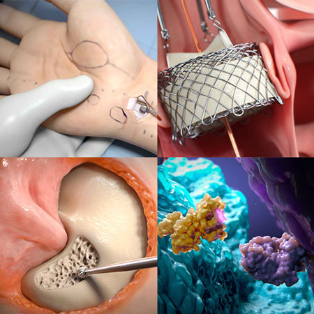 The Best Medical Animation Studios in 2023 | Blog