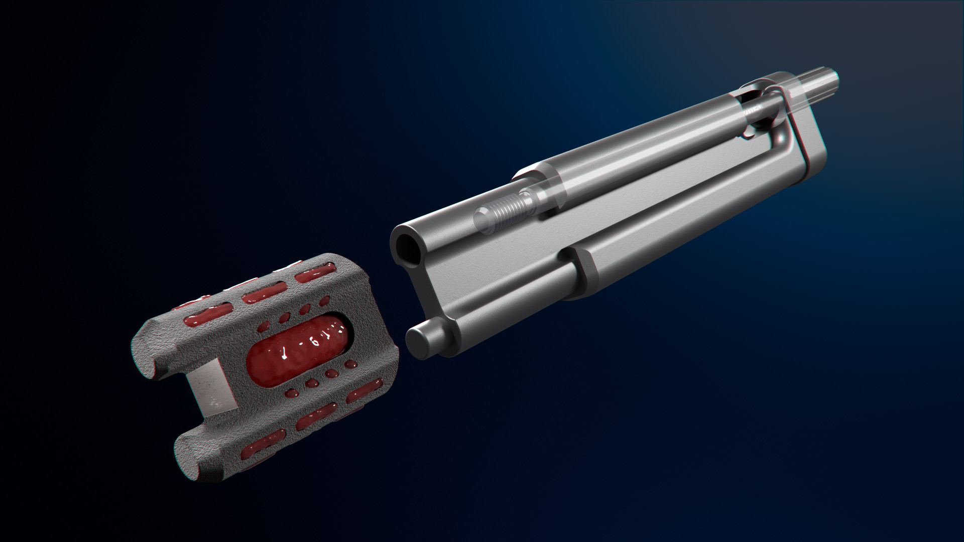 The Catamaran™ SI Joint Fusion System