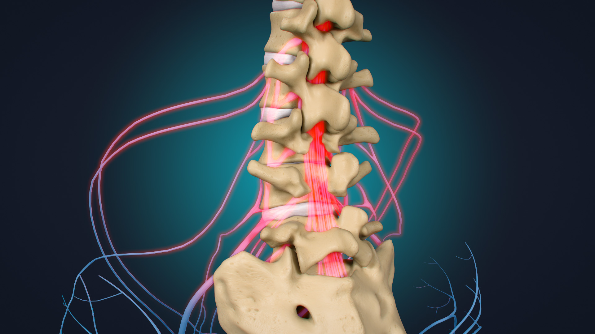 Pain from Lumbar Degenerative Disc Disease