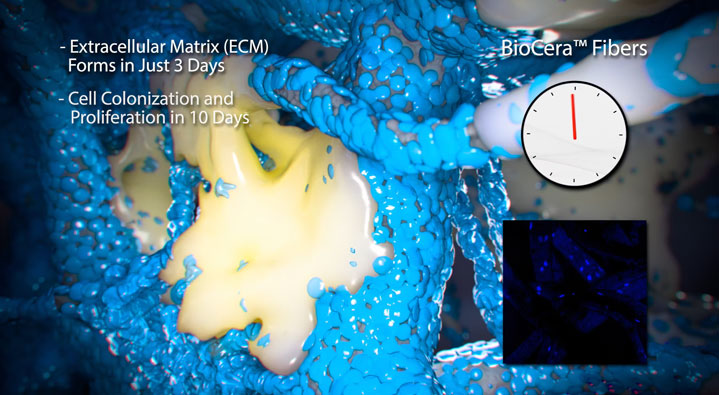 ReBOSSIS® biosynthetic bone scaffolding - Kyocera Animation