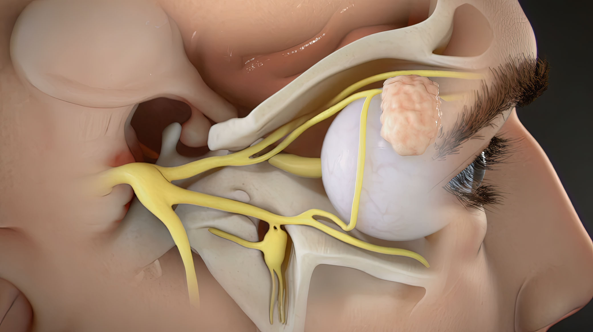 Pulsante Treatment for Cluster Headaches visualized in 3D Animation