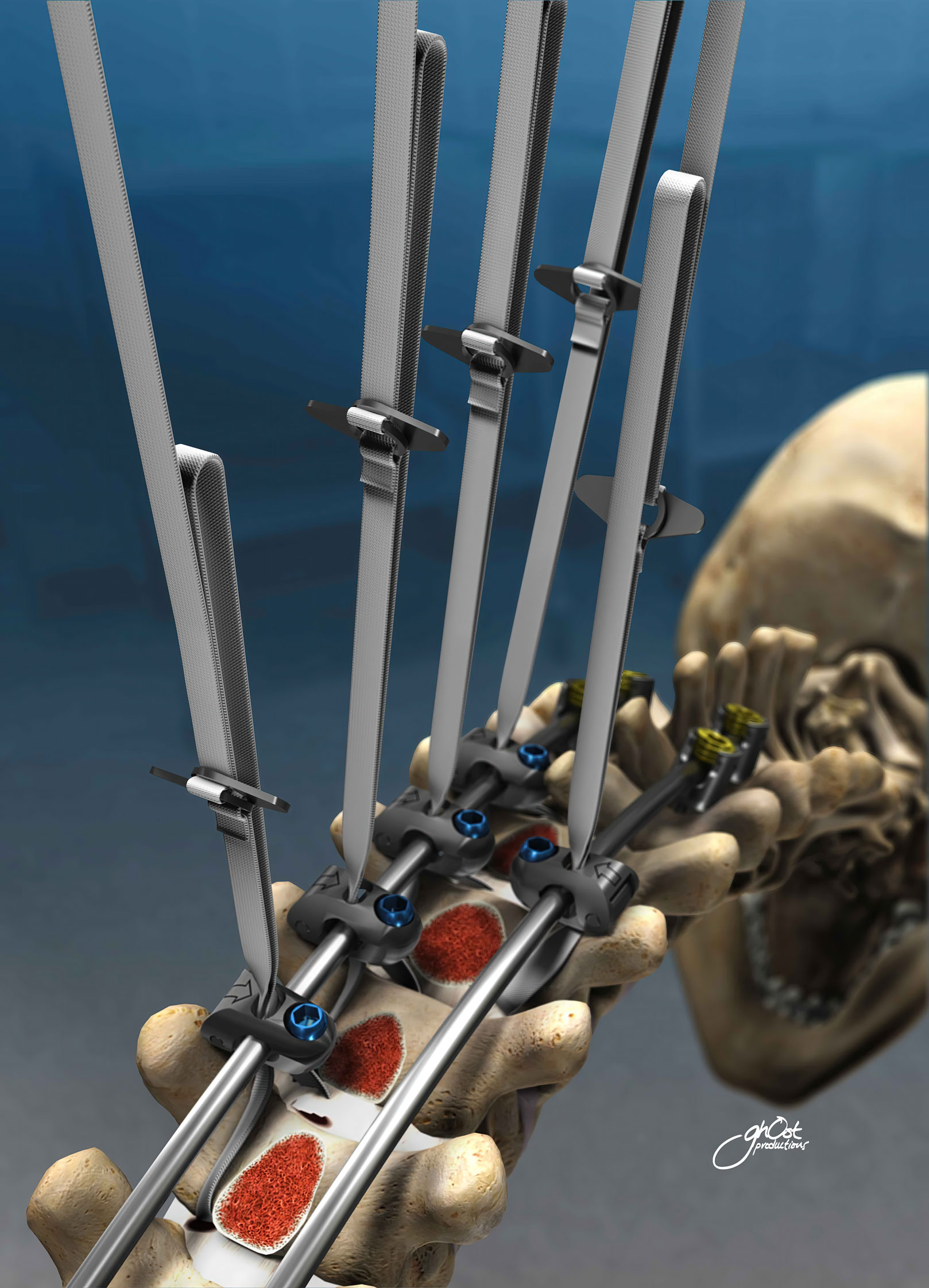 Zimmer Universal Clamp