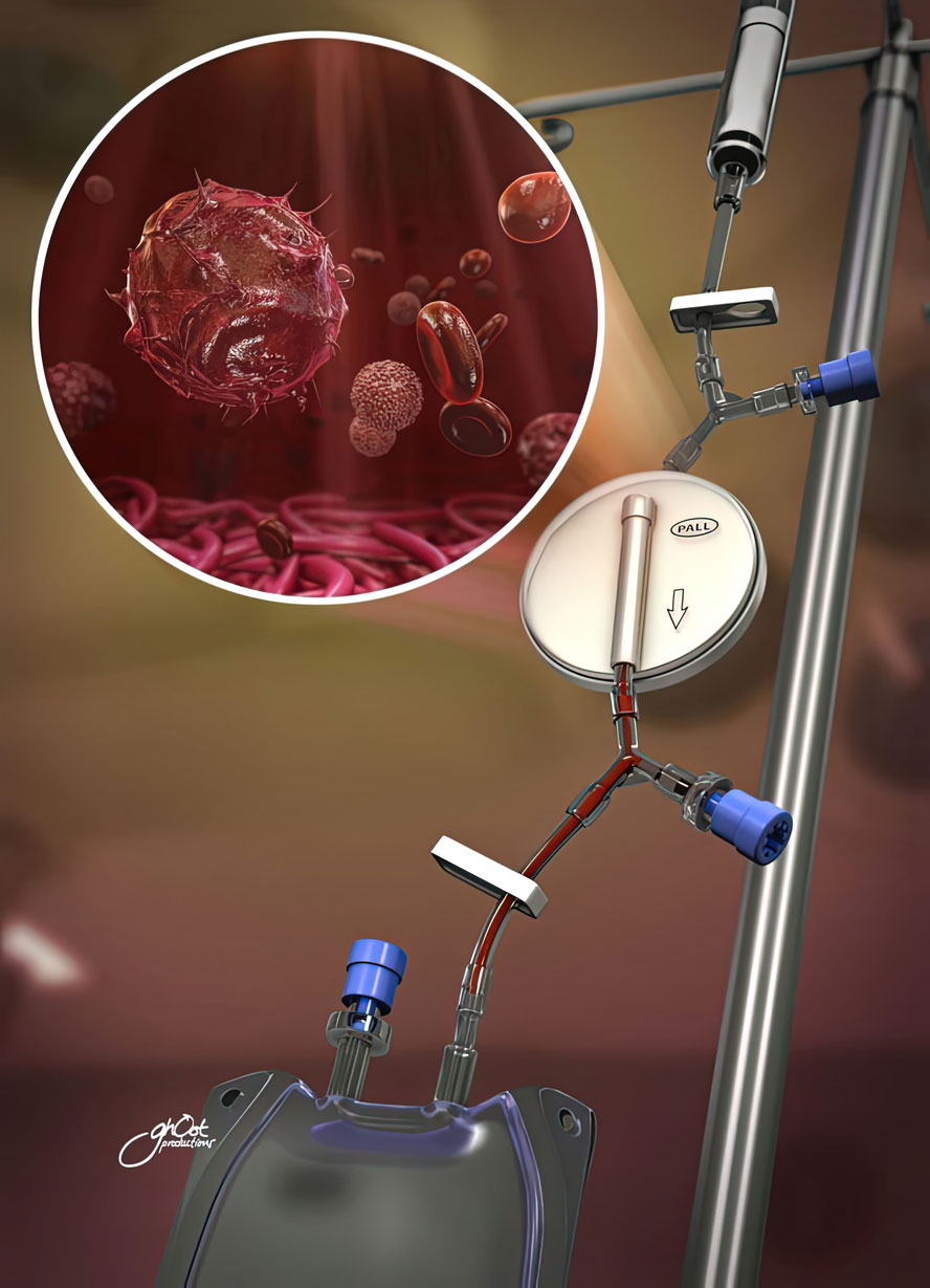 Animation of Pioneer Surgical's Cymbol System, designed for efficient bone marrow processing and extraction of patient-derived MSCs. Shows advanced features and functionality, streamlining extraction process and improving patient outcomes. Created by Ghost Productions. Major breakthrough in regenerative medicine.