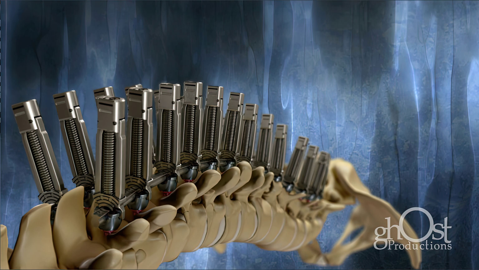 Animation by Ghost Productions for K2M showcasing Range Complex Spine Technology. Treats spinal conditions, demonstrated in surgical technique for Double Major Spinal Deformity. Detailed view of procedure highlights precision and effectiveness of Range technology.