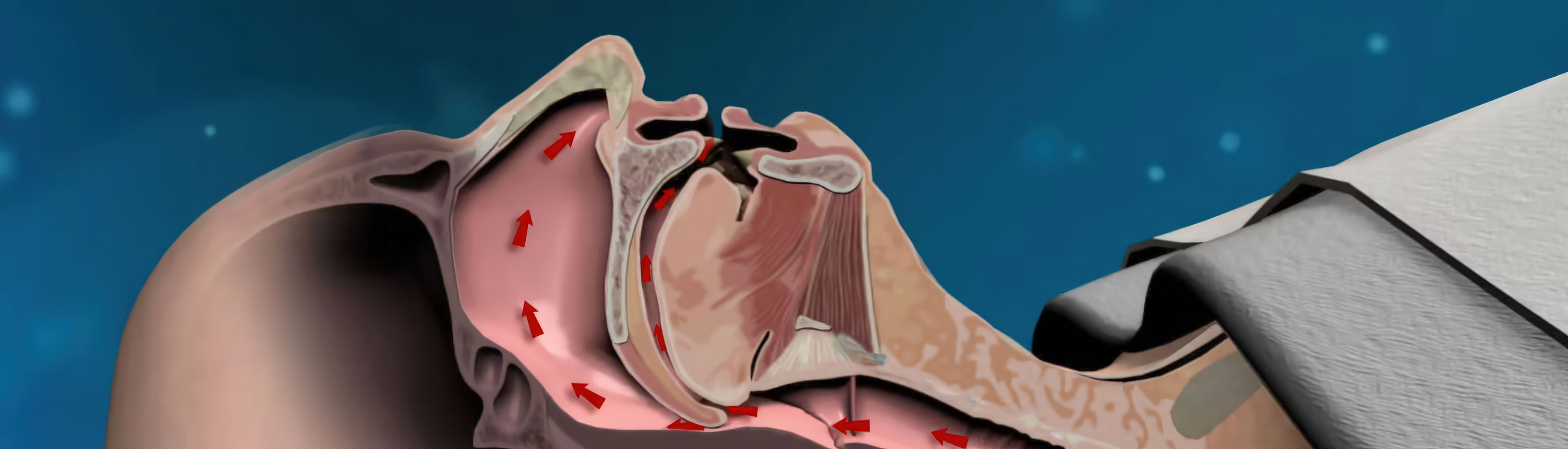 Animation by Ghost Productions for Apnex Medical showing the relationship between airflow and sleep apnea. Illustrates the Apnex device designed for individuals with sleep apnea. Helps educate patients and healthcare professionals about proper airflow during sleep and benefits of the Apnex device.