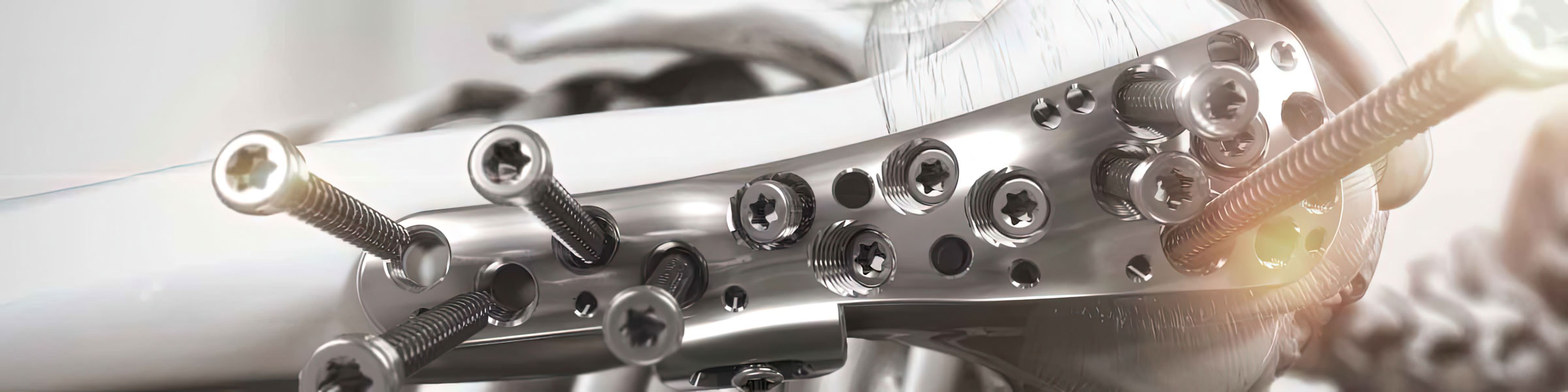 Integra Life Sciences Proximal Humeral Plating Systems illustration showcasing bone plate options for proximal humeral fractures. Provides healthcare professionals with a comprehensive understanding of available treatment options. Helps make informed decisions about patient care.