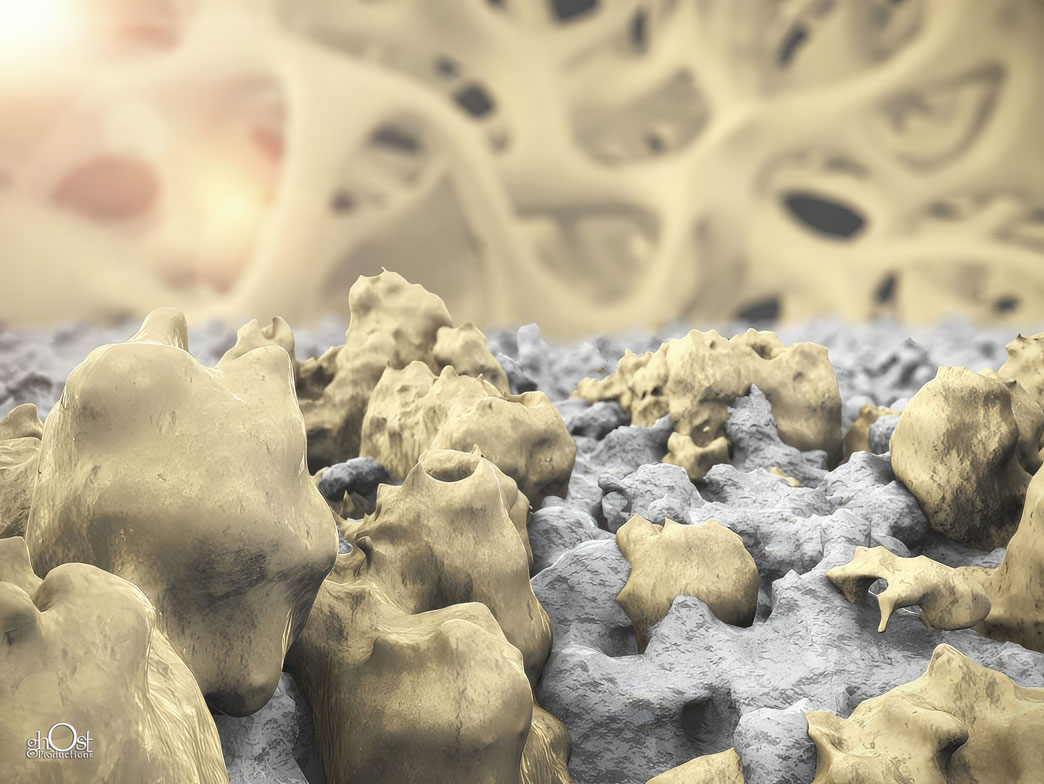 Medical illustration of Plasmapore Osteoconductive Coating, highlighting its benefits for bone growth and regeneration. Ideal foundation for ingrown bone. Created by Ghost Productions. Game-changing solution for orthopedic surgeons and patients.