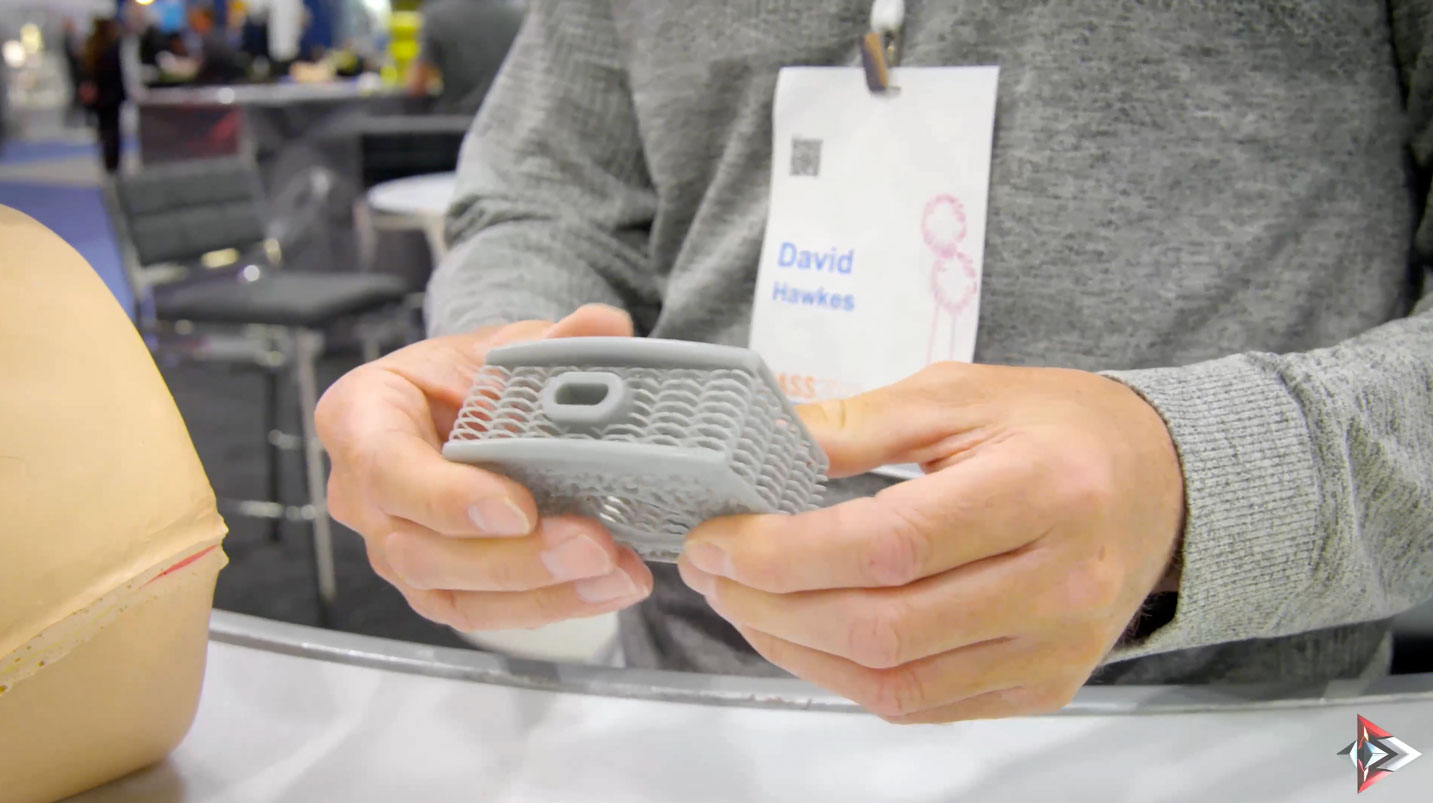 An exclusive interview with David Hawkes, President of Nexus Spine, at the North American Spine Society (NASS) 2023 conference. Discover how Nexus Spine is revolutionizing the world of spinal implants through compliant mechanism engineering and 3D printing technology.