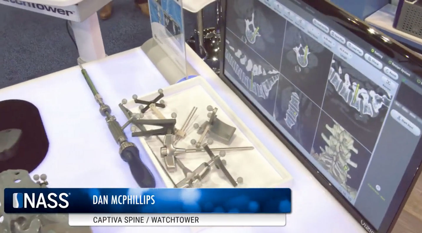 An exclusive interview with Dan McPhillips, the Director of Enabling Technologies and Market Development at Captiva Spine. Captiva Spine, a prominent medical device company, is generating ripples of excitement with its revolutionary WatchTower™ Spine Navigation and Robotics System.