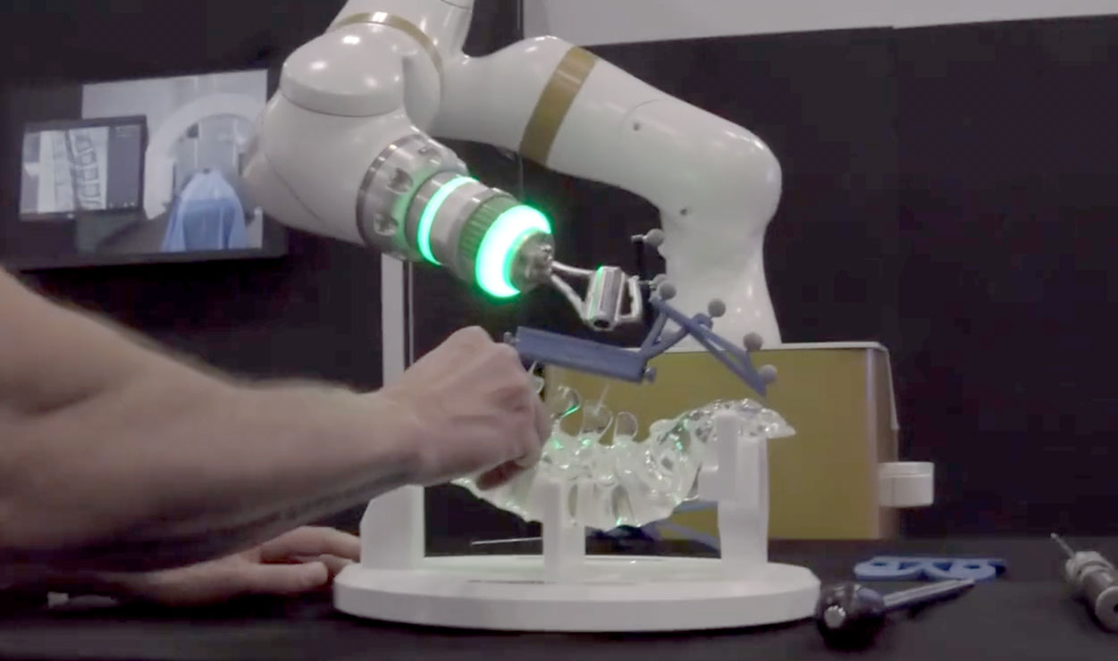 Ecential Robotics introduces the first open surgical assistant robot, designed to seamlessly collaborate with various spine implant manufacturers. Here are the key points covered in this comprehensive interview