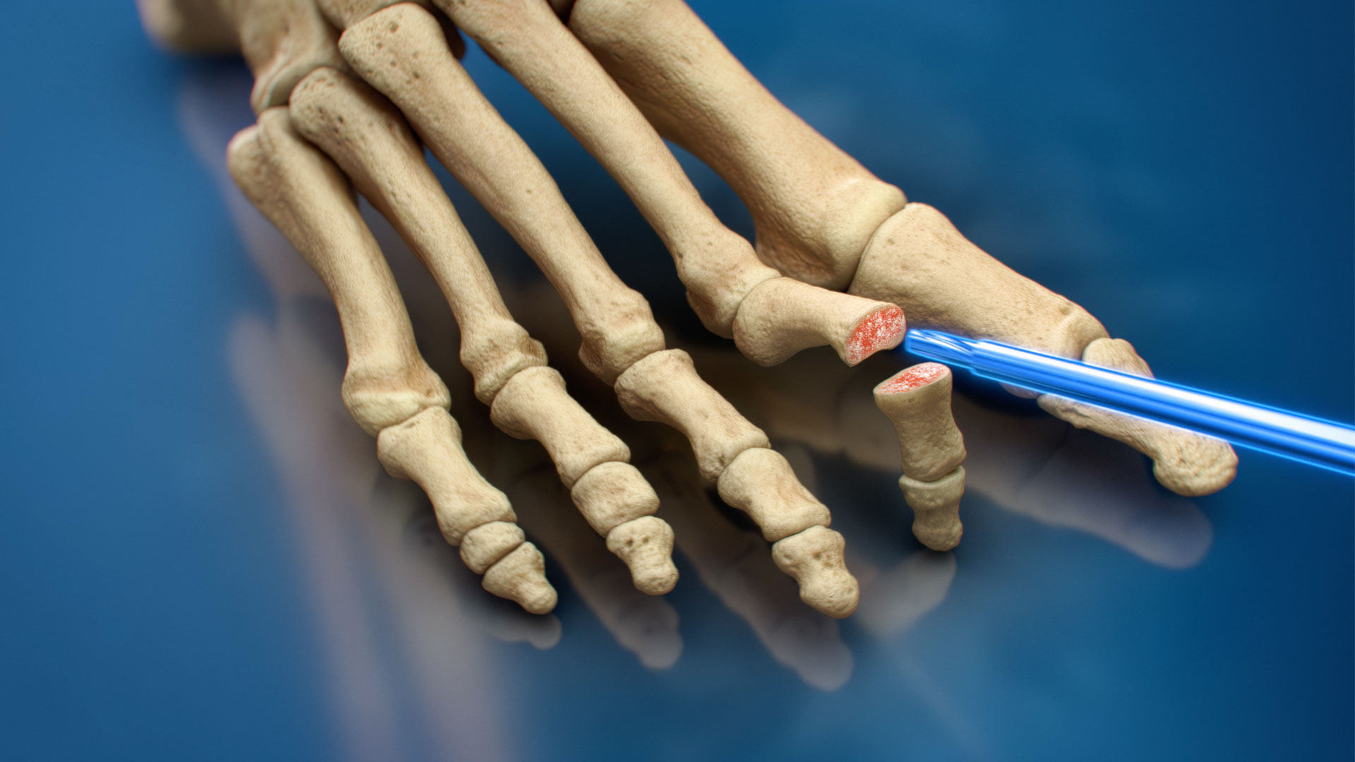 2024 Medical Animation Reel - Ghost Medical