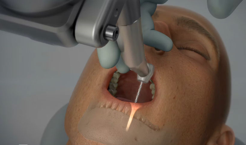 Neocis Nomi Dental Haptic | 2016 Animation