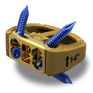 medical-device; medical-illustration; orthopedic